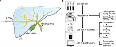 Comprehensive Evaluation and Application of a Novel Method to Isolate Cell-Free DNA Derived From Bile of Biliary Tract Cancer Patients